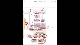 Diabetic Ketoacidosis  Part 4 [upl. by Gnaw]