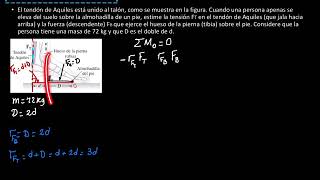 Tratamiento calcificación tendón de aquiles con ondas de choque [upl. by Anauqed]