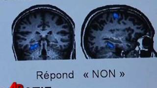 Scientists Talk to Patient in Vegetative State [upl. by Adams966]