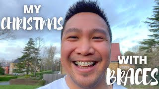 CHRISTMAS WITH BRACES  MONTH 9 UPDATE  Part 1  Ceramic Braces Journal [upl. by Ivan]