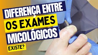 Qual diferença entre os Exames micológicos na podologia [upl. by Yr]