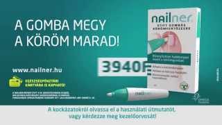 Nailner commercial  Hungary [upl. by Cloris835]