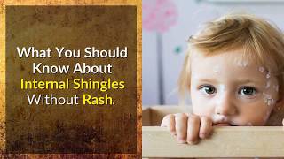 Signs And Symptoms Of Internal Shingles How To Detect Infection Early [upl. by Cath223]