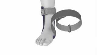 Bauerfeind MalleoLoc® Ankle Brace [upl. by Akeit]