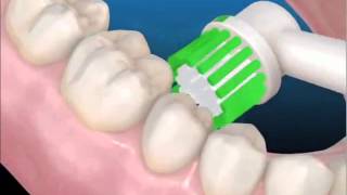 La correcta técnica de cepillado con cepillo eléctrico [upl. by Dace93]