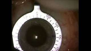 Anatomy of the Limbus complete lecture – Surgical Limbus Incision site Limbal Stem cells [upl. by Suiramad]