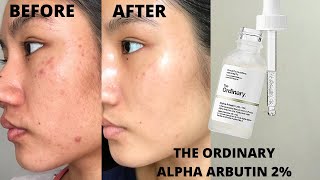 ALL THE ORDINARY VITAMIN C PRODUCTS Dermatologist Review  Dr Dray [upl. by Washburn]