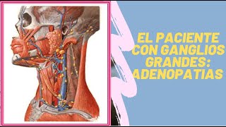 EL PACIENTE CON GANGLIO GRANDES ADENOPATIAS [upl. by Hamlen]