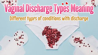 Vaginal discharge types meaning  discharge color odor shape and diseases shorts [upl. by Hyacinthie]