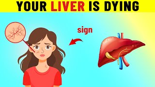 10 Early Warning Signs of Fatty Liver Disease [upl. by Nedak]