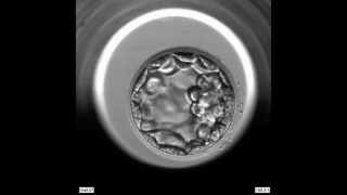 EmbryoScope Embryo Development  Blastocyst [upl. by Decca]