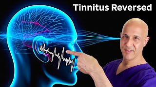 Tinnitus Reversed The Miracle of 1 Nutrient Dr Mandell [upl. by Zoara]