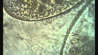 Paramecium trichocyst discharge [upl. by Rennoc]