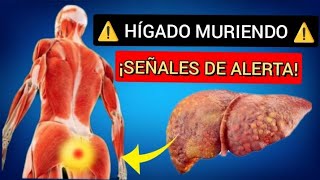 ¿Tu HÍGADO está MURIENDO 8 señales de ALERTA😨 [upl. by Forsta156]