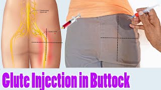 How to give IM intermuscular injection in buttock or hip at home Dorsogluteal injection technique [upl. by Olmsted577]