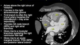 Coronary Arterial Anatomy [upl. by Parsons968]