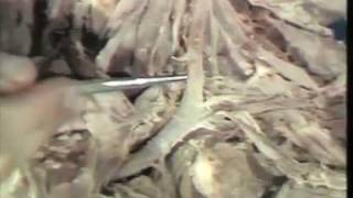 Gross Anatomy Subclavian Artery and Visceral Section of Neck [upl. by Barry]