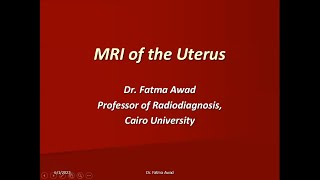 13 Female Pelvis 1  Uterus  Prof Dr Fatma Awad [upl. by Anair36]