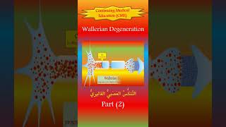 The Wallerian Degeneration 2 The New Pathophysiology [upl. by Alakcim]