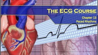 The ECG Course  Paced Rhythms [upl. by Kuehnel853]