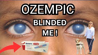 Blindness From Ozempic The New Side Effect  Dr Messina Explains NAION [upl. by Boswell]