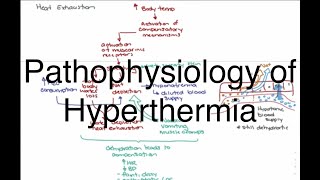 Hyperthermia Pathophysiology [upl. by Osswald]