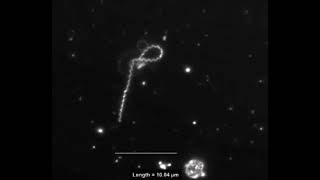 Interaction of Treponema pallidum the syphilis spirochete with human platelets [upl. by Aubrey]