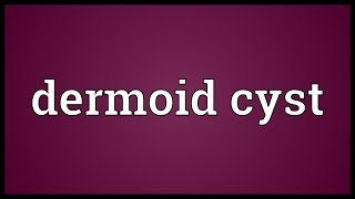 Dermoid cyst Meaning [upl. by Nakah]