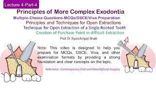 Lecture 4 Part4 MCQs  Open Extraction of Single Rooted Tooth  OSCE  VIVA [upl. by Elisha978]