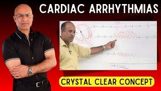 Cardiac Arrhythmias  Tachycardia and Bradycardia  Cardiology [upl. by Alicsirp]