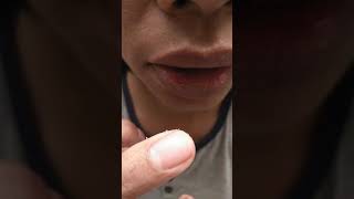 Putting salt on canker sore  mouth ulcer [upl. by Garibald]