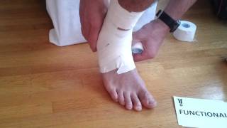 Ankle Taping  Tape Your Own Ankle COMPLETE [upl. by Wsan]