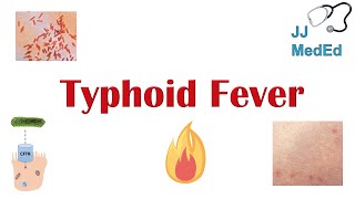 Typhoid Fever Pathogenesis vectors bacteria Symptoms Diagnosis Treatment Vaccine [upl. by Egoreg]