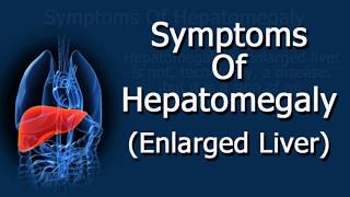 Symptoms Of Hepatomegaly Enlarged Liver [upl. by Airbmak]