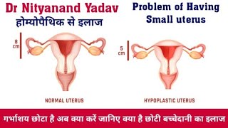 Treatment of Hypoplastic uterus with homoeopathic medicine with documentary proof [upl. by Halliday536]