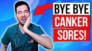 How to get rid of canker sores inside your mouth fast and treatment [upl. by Cecilla]