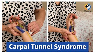 Carpal Tunnel Syndrome [upl. by Elocal594]