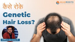 Genetic Hair Loss को कैसे रोके  How to control Genetic Hair Loss  Explained by Dr Alok Sahoo [upl. by Noryt]