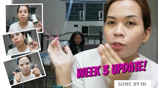 Get Unready with Me  Week 3 Update  iheartdotie [upl. by Acinorej452]