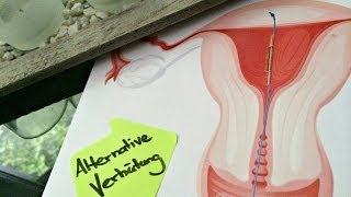 ALTERNATIVE VERHÜTUNGSMETHODE OHNE HORMONE  ERFAHRUNGEN MIT DER PILLE [upl. by Ulick602]