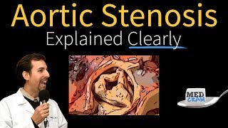 Aortic Stenosis Explained Clearly  Diagnosis and Treatment [upl. by Chace]