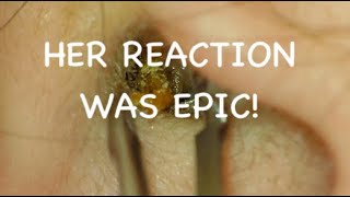 EAR WAX REMOVAL  HER REACTION WAS EPIC  4KHD [upl. by Giesser998]