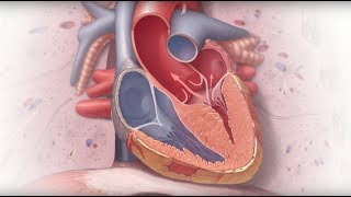 Genetics and Cardiomyopathy  Mayo Clinic [upl. by Naimad]