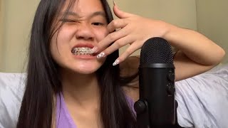 ASMR Whispering  About My Dental Braces amp Other Things [upl. by Gayner]