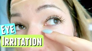 EYE IRRITATION FROM EYELASH EXTENSIONS [upl. by Sulihpoeht]