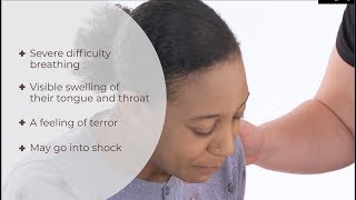 What is anaphylaxis  Anaphylactic shock  First Aid  iHASCO [upl. by Nylyahs]