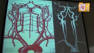 Diagnóstico por Imagen  Arteriografía Cerebral [upl. by Deery]