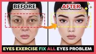 ✨ EYES EXERCISE to Reduce dark circles Wrinkles Bags under the eyes Tear Troughs Droopy eyelids [upl. by Attenov]