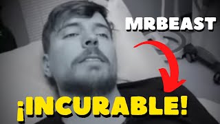 😱 EXTRAÑA ENFERMEDAD  Que Padece MrBEAST [upl. by Ainit]