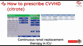 Continous renal replacement therapy in ICU [upl. by Arley]